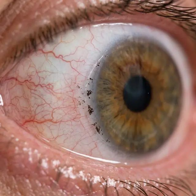 Частицы косметики под флэпом