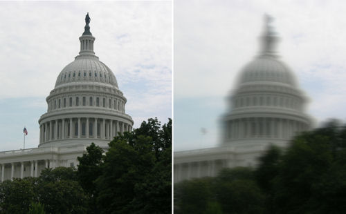 blurry vision after LASIK